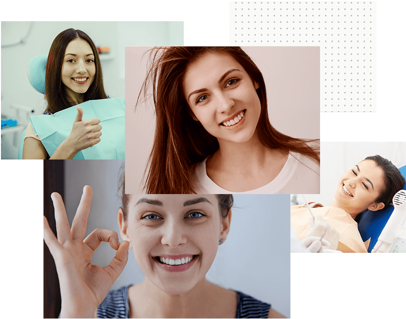 Smile Makeover Veneers